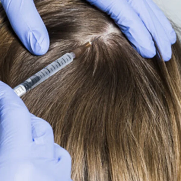 Mesotherapy Hair Treatment in Pune | Best Dermatologist | The Daily ...