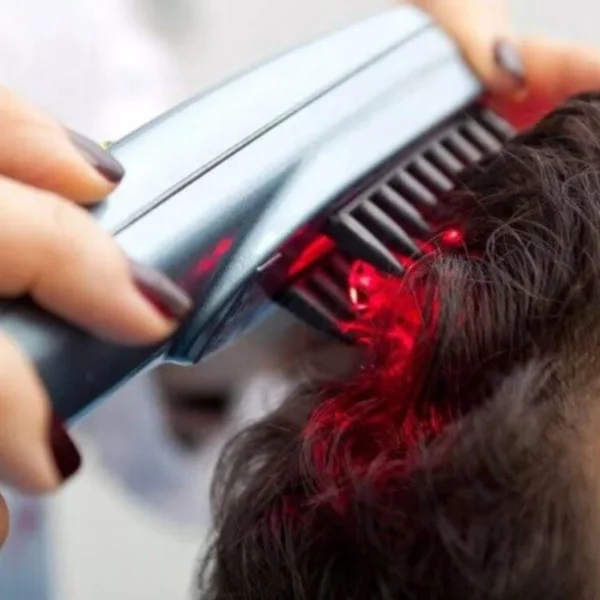 Laser Hair Stimulation Treatment in Pune