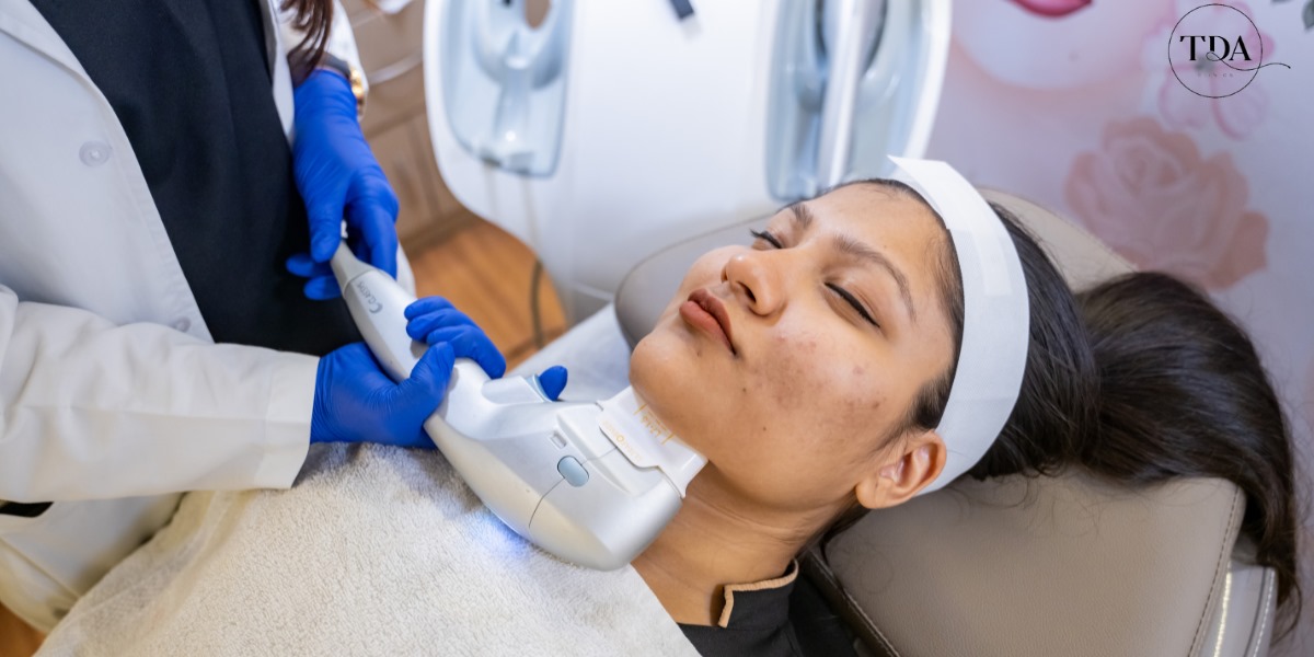 acne treatment in pune