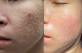Dermatologist in Viman Nagar