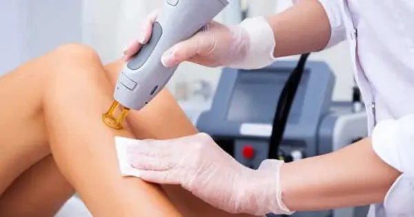 Laser Hair Removal
