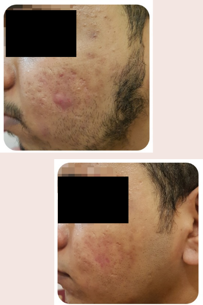 Skin Allergy