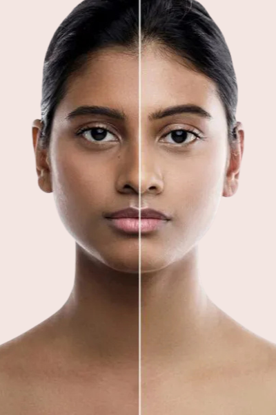 Skin Tan Removal