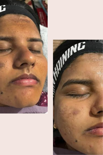 BB Glow Facial