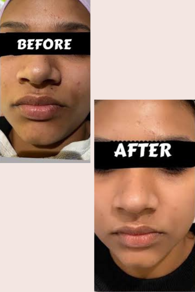 BB Glow Facial