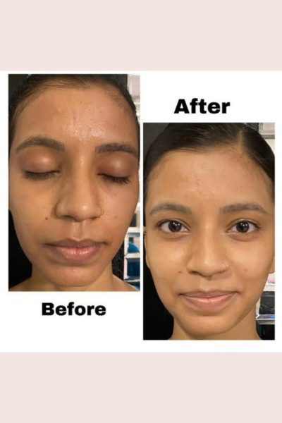 BB Glow Treatment
