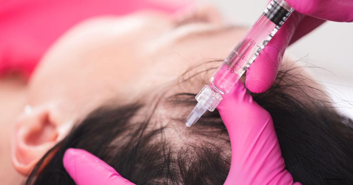 PRP Hair Treatment