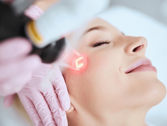 Laser skin Treatment
