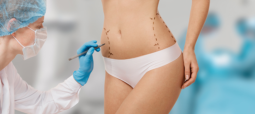 Body Contouring