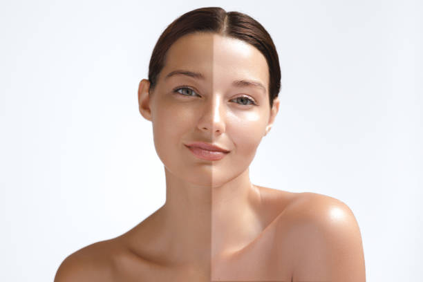Skin Whitening