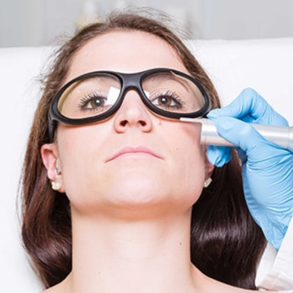 Mole Removal