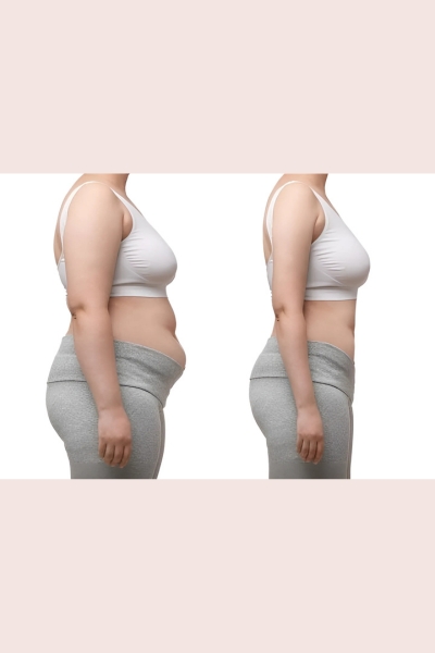 Non Surgical Inch Loss Treatment