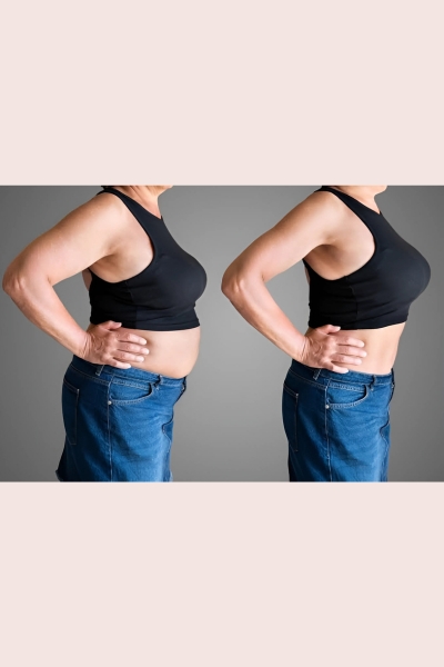 Non Surgical Inch Loss Treatment