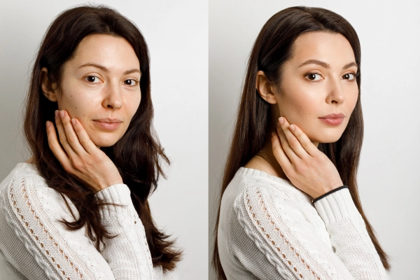 Skin Whitening Treatments