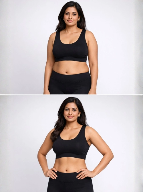 Benefits of Non-Surgical Inch Loss Treatment