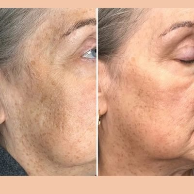 WhatsApp Image 2025-05-23 at 10.38.16_98ecb21b WhatsApp Image 2025-05-23 at 10.38.16_98ecb21b